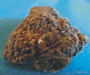 бронхиальная астма мумие